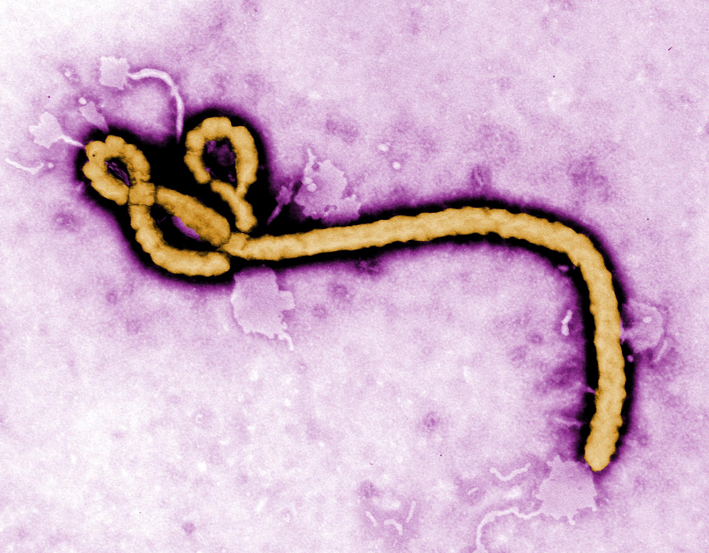 Maladie à virus Ebola (souche Bundibugyo)